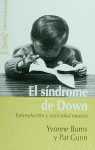 El síndrome de Down