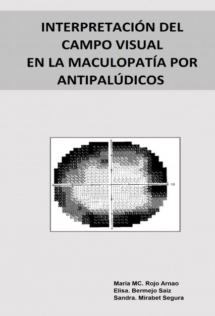 INTERPRETACIÓN DEL CAMPO VISUAL EN LA MACULOPATÍA POR ANTIPALÚDICOS